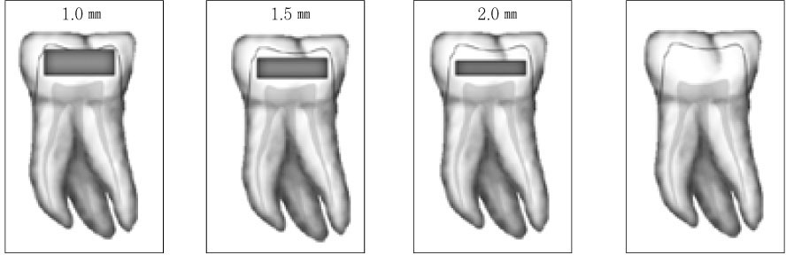 jkacd-33-177-g001.jpg