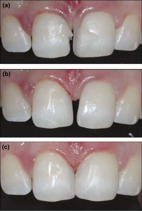 jkacd-36-515-g005.jpg