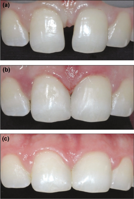 jkacd-36-515-g006.jpg