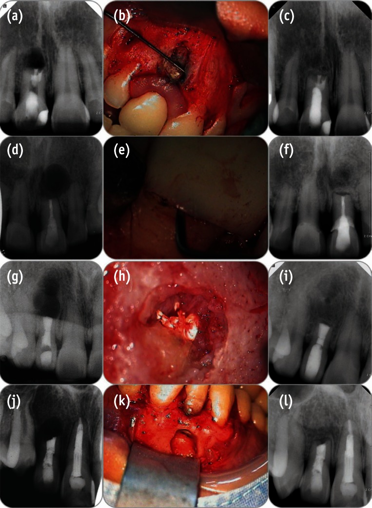 rde-38-59-g005.jpg